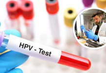 Australija briše rak grlića materice: Kod nas strah i neznanje ubijaju mlade žene